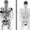 Exame de imagem mostra a redução dos tumores em pacientes que testaram droga experimental. Foto: Peter MacCallum Cancer Center