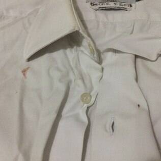 Oscar publicou foto da camisa branca manchada de sangue