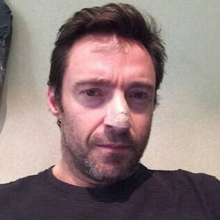 Hugh Jackman:
