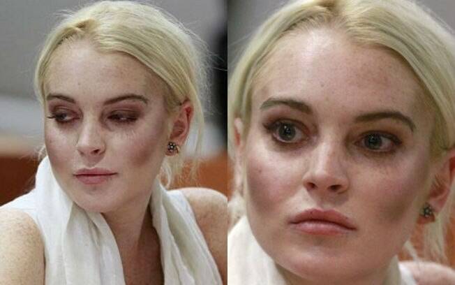 Lindsay Lohan já errou em outra ocasião. A atriz escolheu um blush muito escuro para usar em seu julgamento e o efeito ficou parecido com o de hematona
