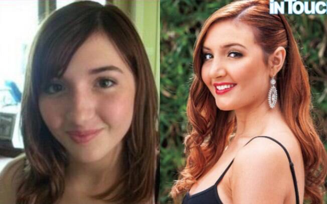 Ashley Horn: antes e depois das plásticas