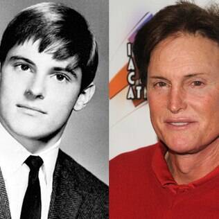 Em 2013, Bruce Jenner chegou a fazer uma cirurgia para diminuir o seu Pomo de Adão