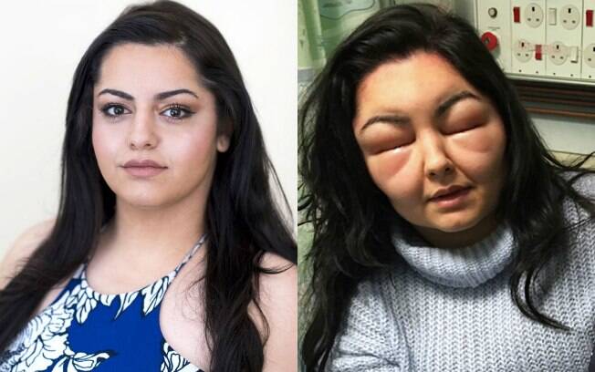Levar os olhos inchados depois de um sonho