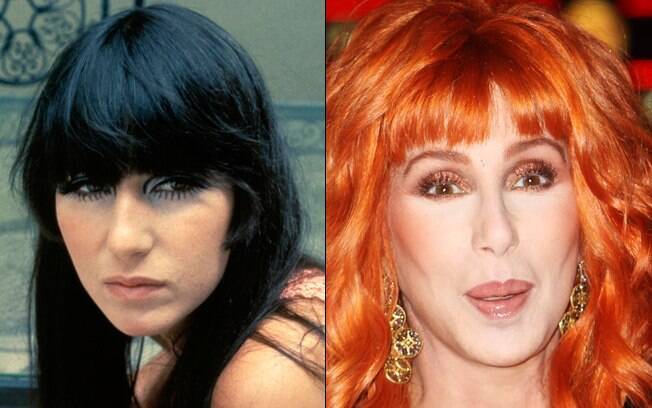 Cher já recorreu a inúmeras plásticas para não envelhecer