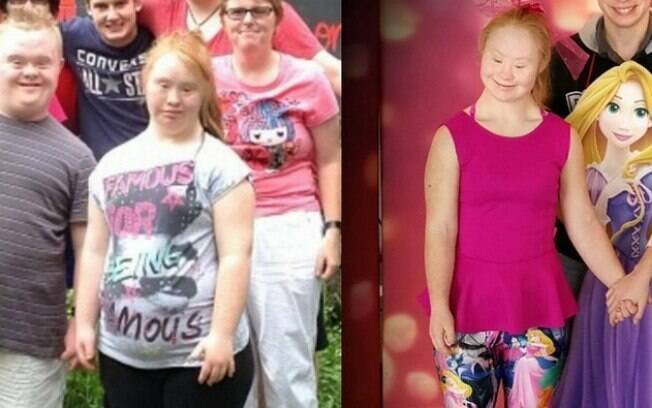 Madeline antes e depois de perder 20 kg. Foto: Reprodução