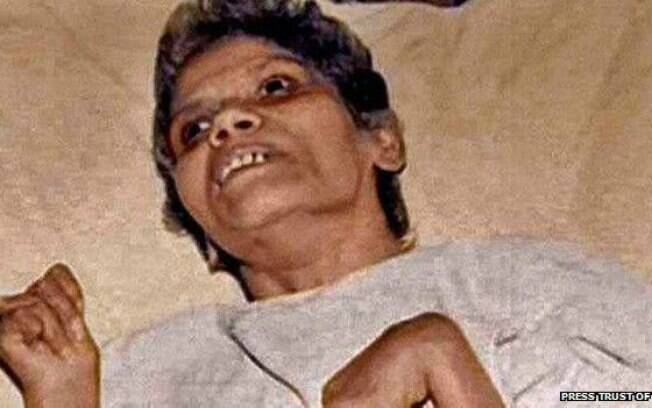 Médicos e enfermeiras do hospital onde Aruna Shanbaug ficou internada eram contra sua eutanásia