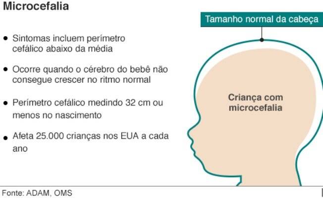 Microcefalia é quando bebês nascem com perímetro cefálico medindo 32 cm ou menos