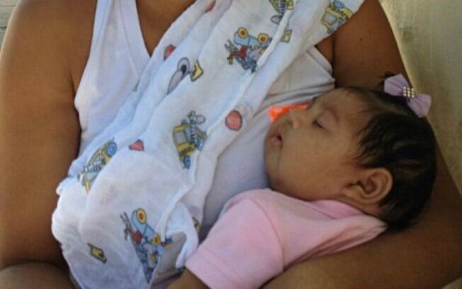 Vans de prefeituras do interior de Pernambuco levam mes e bebs com microcefalia para Recife