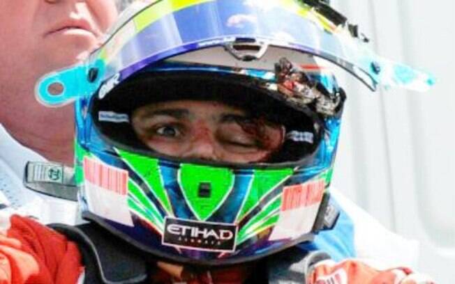 Felipe Massa é socorrido após o acidente no GP da Hungria que o tirou do fim da temporada de 2009