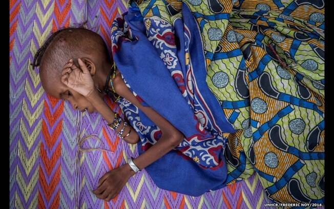 'Apesar de estar visivelmente marcada pela fome, ela (criança) se mantém graciosa', diz Frédéric Noy. Foto: Frédéric Noy/Acnur
