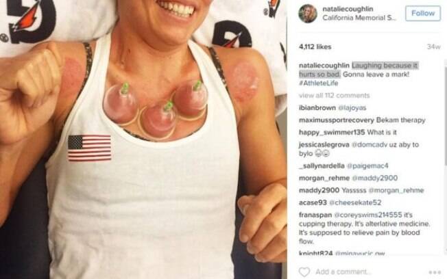 Sorriso da nadadora norte-americana Natalie Coughlin era pela dor que ela estava sentindo no momento da terapia Sorriso da nadadora norte-americana Natalie Coughlin era pela dor que ela estava sentindo no momento da terapia