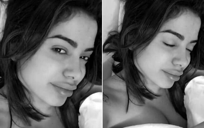 Anitta posa sem sutiã e vira piada com boca inchada: 