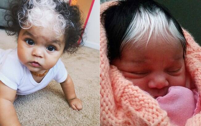 Bebê nasce com cabelo branco exatamente igual ao da mãe