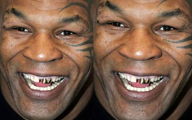 Myke Tyson: o lutador não esconde os dentes separados e coloca grills em alguns deles