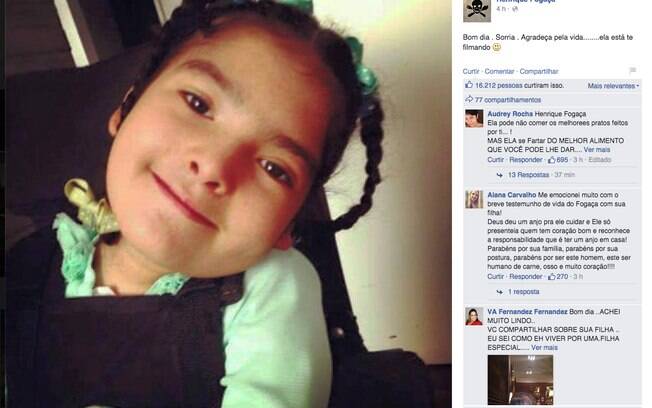 Fogaça sensibilizou todo mundo depois de revelar que sua filha é portadora de deficiência e precisa se alimentar por sonda