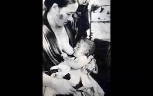 Fotos raras mostram feridos momentos depois de bomba atômica atingir Hiroshima