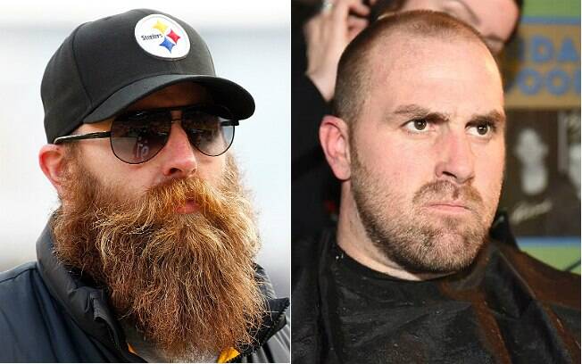 Brett Keisel em dezembro de 2014 (esquerda) e no início de fevereiro de 2015 (direita)