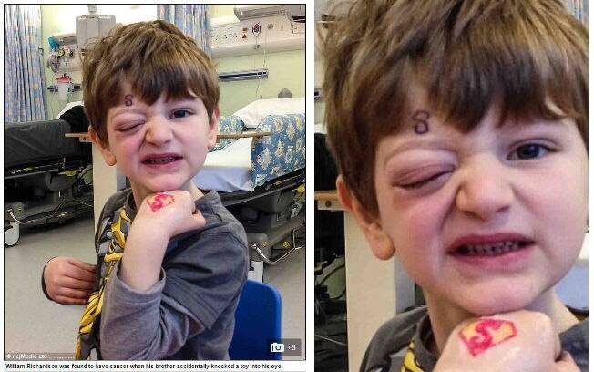 William descobriu um tumor raro depois de machucar o olho com um brinquedo 