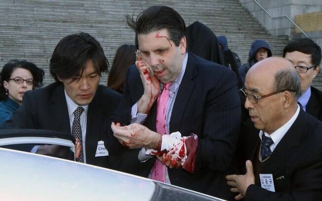 Mark Lippert tenta conter sangramento enquanto é encaminhado a hospital na capital sul-coreana