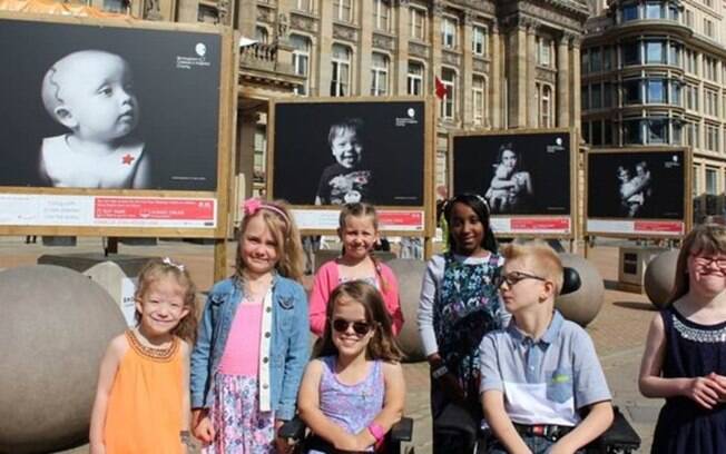 Retratos e histórias de crianças com doenças raras atendidadas por hospital na Inglaterra são exibidas em exposição