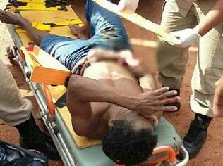 Homem foi ferido no braço direito no ataque