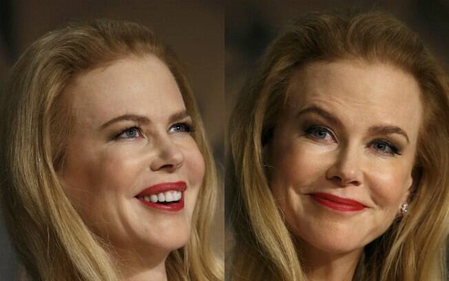 Nicole Kidman surge com lábios inchados e quase irreconhecível em tapete vermelho de Cannes