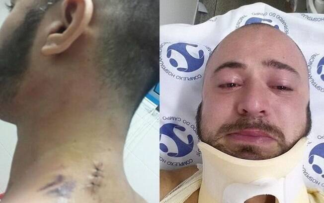 Rodrigo Kirchoff mostrou fotos dos ferimentos em sua rede social