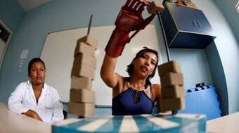 Professor inventa prótese mecânica que diminui custo de R$ 10 mil para R$ 200