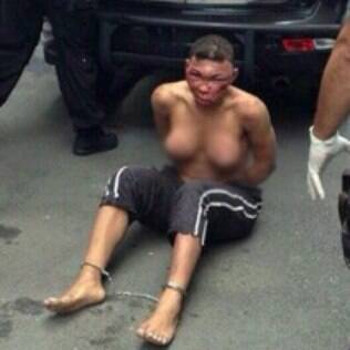 Foto que vazou da travesti Verônica a mostra com o rosto desfigurado, seios descobertos e pés acorrentados