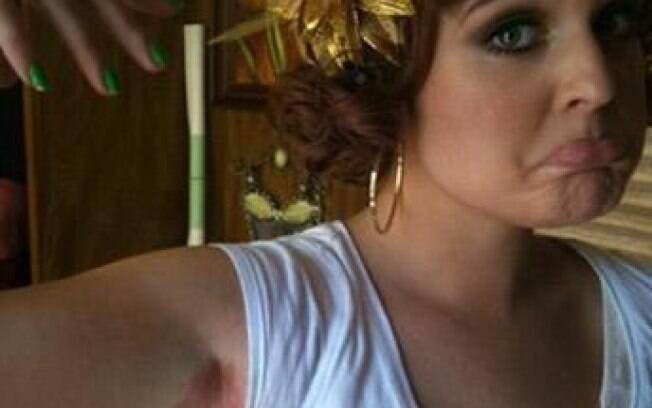 Kelly Osbourne postou uma foto de sua axila assada