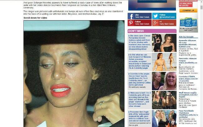Solange Knowles tem reação alérgica