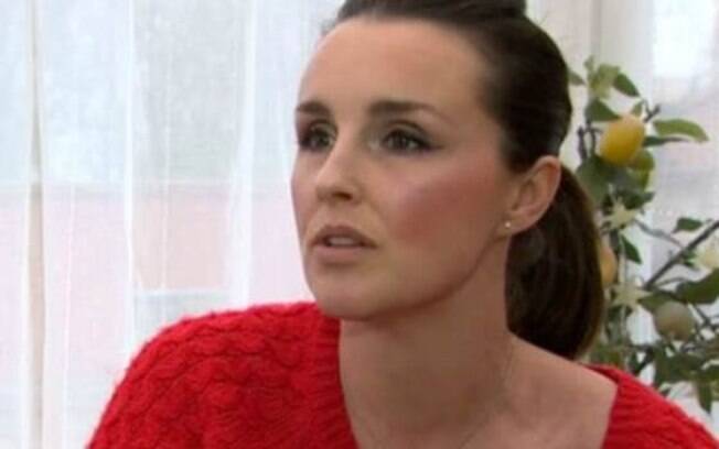 Rachel Williams foi baleada pelo marido em 2011 (06.03.15)