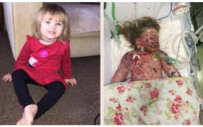 Pais da menina decidiram compartilhar fotos dela no hospital para apoiar campanha