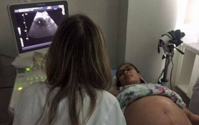 Obstetra defende que se passe a falar em “síndrome da Zika congênita