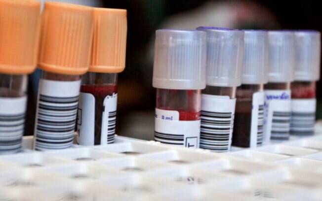 Exame de sangue diagnostica depressão em adultos. Foto: Thinkstock/Getty Images