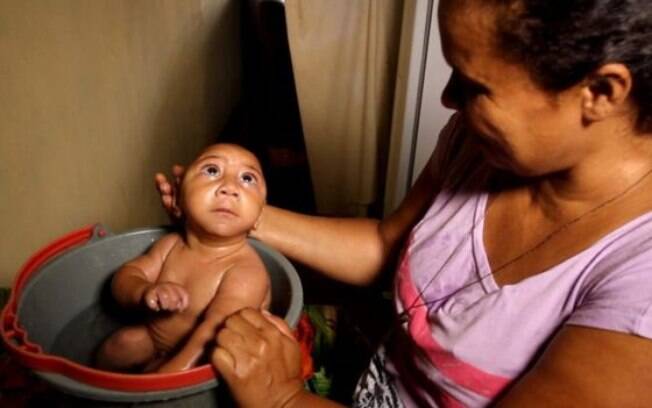 Bebê que ficou conhecido por foto de banho no balde foi internado com pneumonia e se recupera no hospital em Pernambuco
