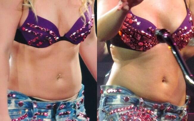 O efeito sanfona é tão presente na vida de Britney, que em seis meses ela exibiu a diferença acima na barriga