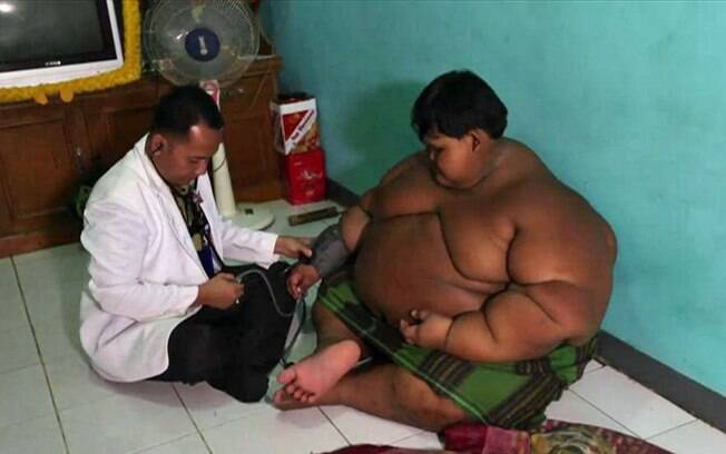 Aos 10 anos, menino da Indonésia pesa mais de 180 kg