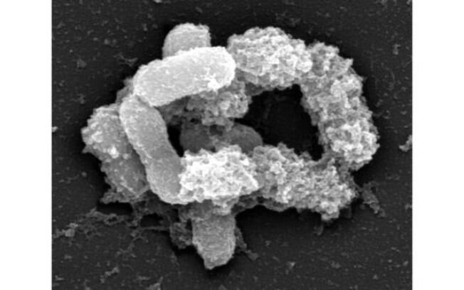 Bactéria Akkermansia muciniphila: proteína estudada na Bélgica faz parte da membrana externa da bactéria Bactéria Akkermansia muciniphila: proteína estudada na Bélgica faz parte da membrana externa da bactéria