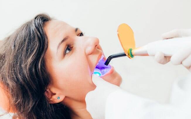 Usando gel à base de peróxido de hidrogênio,o tratamento no consultório é ativado por luzes como laser e LED