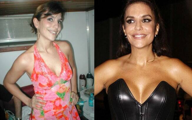 Ivete Sangalo colocou 200ml de silicone em cirurgia realizada em 2006. Foto: AgNews/Foto Rio News/Divulgação/Reprodução