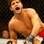 Canadense Patrick Côté lesionou o joelho no meio do combate contra o paulista. Foto: Getty Images