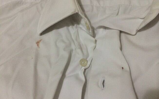 Oscar publicou foto da camisa branca manchada de sangue