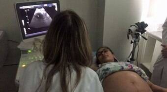 Casos de bebês com microcefalia chegam a 1.384 no País; mortes passam de 50