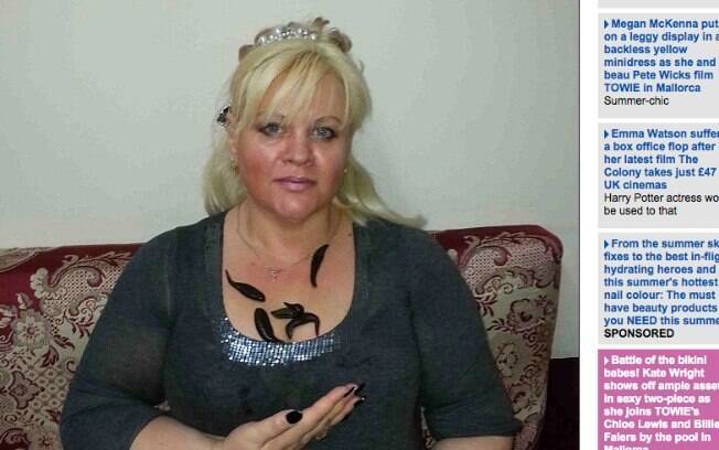 Alex Bogatyriova é adepta de terapias com sanguessuga