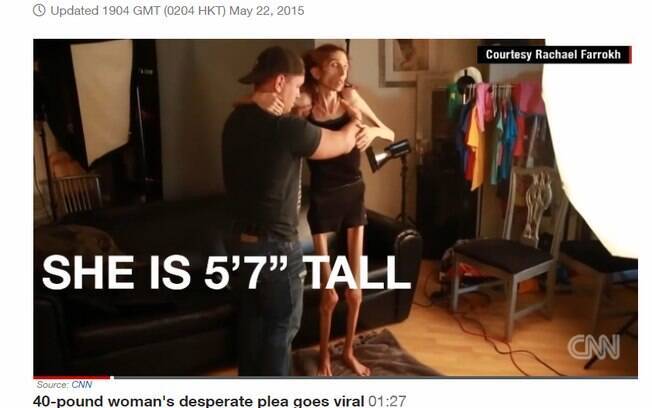 1,70 de altura com 18 quilos representa um IMC de 6,3. O normal está entre 18,5 a 24,99. Foto: Reprodução/CNN