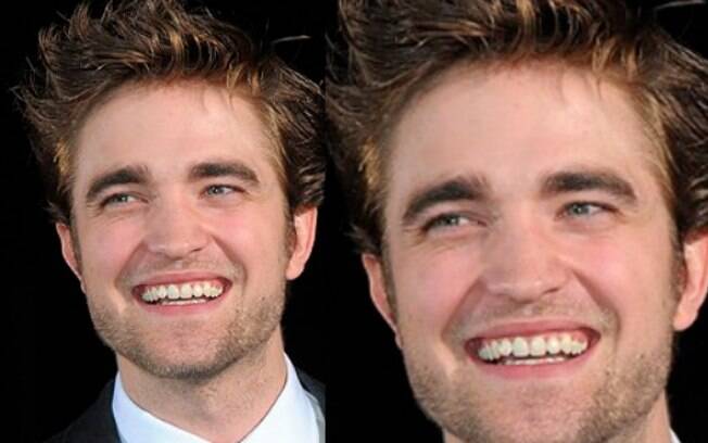 Robert Pattinson mostra um sorriso natural e não se preocupa em deixá-los um pouco tortos 