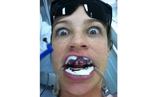 Sorriso global: Luana Piovani usou sua conta no Twitter para mostrar a limpeza que está fazendo nos dentes