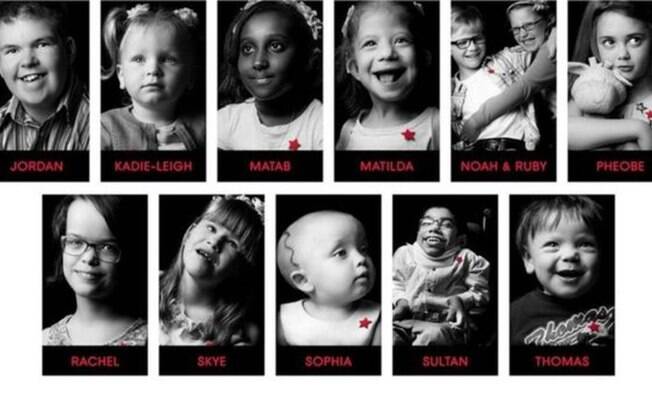 Retratos de 11 pacientes portadores de doenças raras ou ainda não diagnosticadas que fazem parte da exposição 