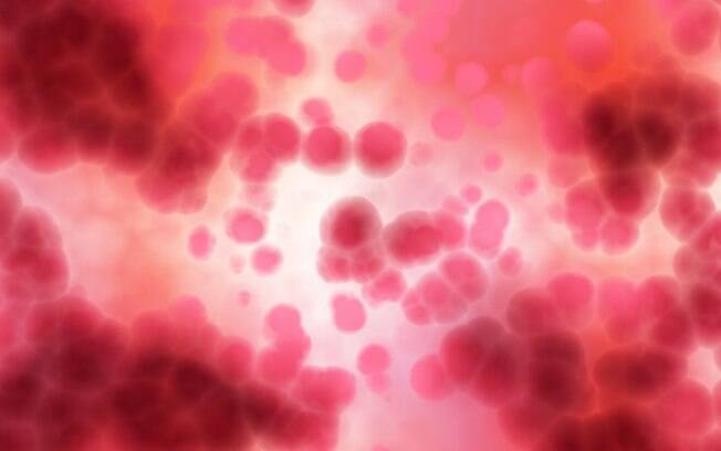 Aids é uma doença que afeta o sistema de defesa do corpo, já que o vírus HIV ataca e mata os glóbulos brancos Aids é uma doença que afeta o sistema de defesa do corpo, já que o vírus HIV ataca e mata os glóbulos brancos